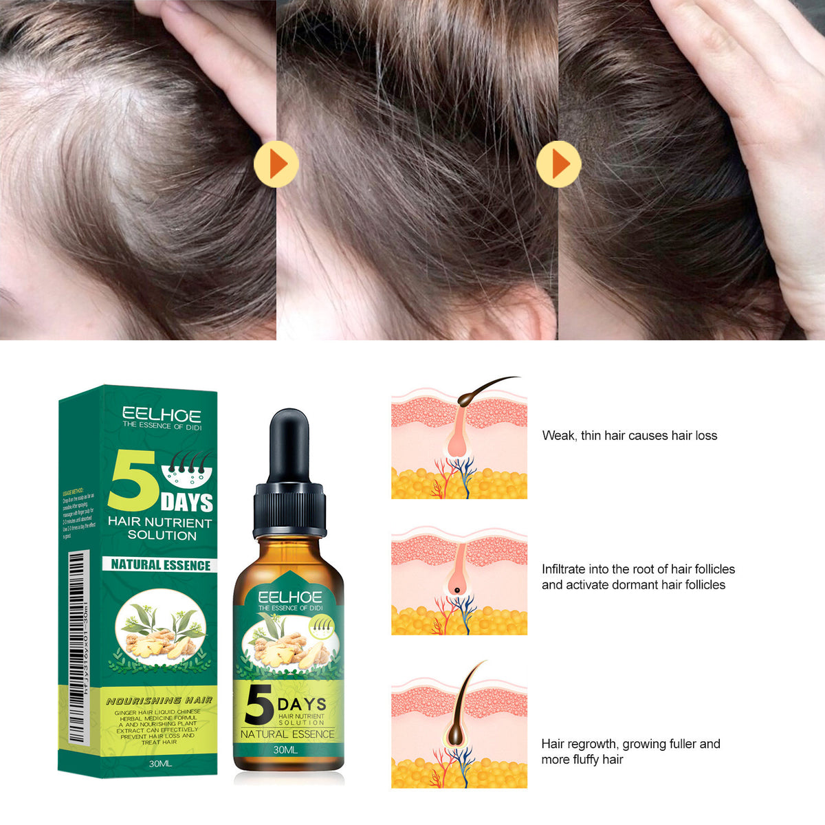 EELHOE Ginger Hair Oil Moisturizing Smooth Hair Repair Frizzy Damaged Hair Care Essential Oil