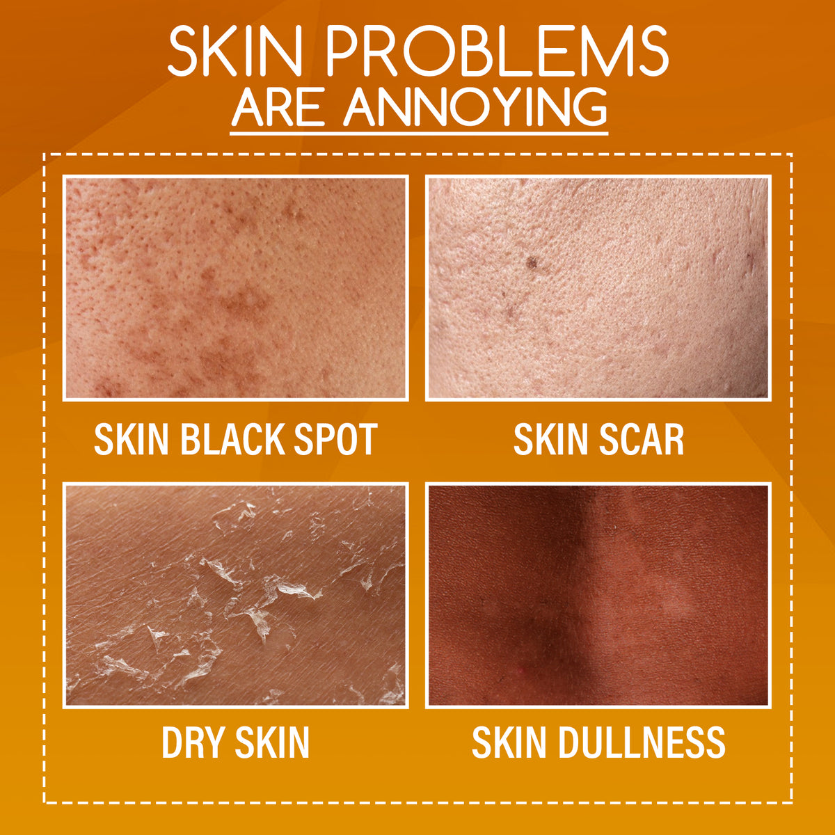 OUHOE Orange Peel Body Lotion, Exfoliation Lightening Dark Spots Brightening And Moisturizing Skin Treatment Lotion