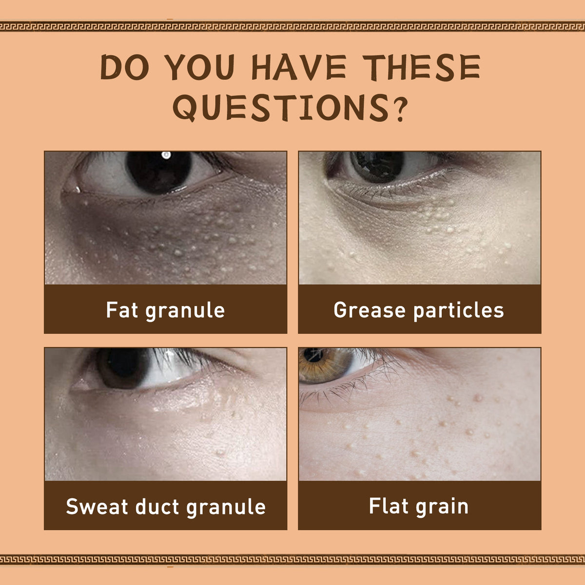 EELHOE Gentian Eye Cream, Improve Eye Fat Granules Firming Fine Line Around Eye Bags Moisture Lock Eye Cream