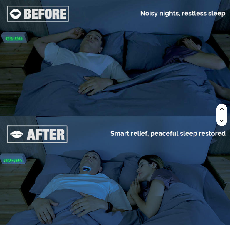 Cloud Flying YA4600 AI Intelligent Breathing Algorithm Throat Massager Snore Stopper