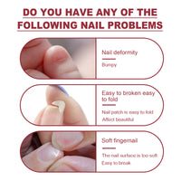 Jaysuing Fiber Extension Gel (20ml) Nail Anti-Crack Nail Art Nail Light Therapy Extension Gel Burst Nail Gel