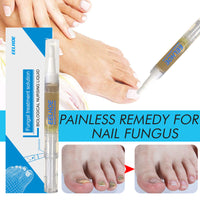 EELHOE Nail Care Solution Hand, Foot And Nail Care Clean Soft Nails Daily Gentle Moisturizing And Curing Polish Solution