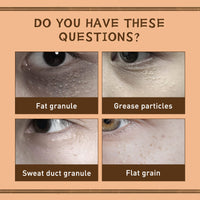 EELHOE Gentian Eye Cream, Improve Eye Fat Granules Firming Fine Line Around Eye Bags Moisture Lock Eye Cream