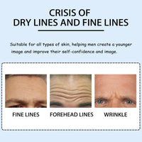 East Moon Anti-Wrinkle Forehead Patch For Men, Firming Forehead And Reducing Fine Lines And Wrinkles