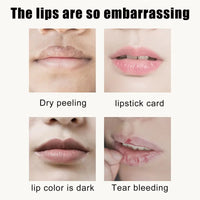 EELHOE Cherry Crystal Lip Mask Hydrates And Moisturizes Lips, Removes Dead Skin Without Greasy And Reduces Lip Lines