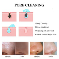 EELHOE Blackhead Removal Mask Deeply Cleanses Pores, Lightening Blackheads, Oil Control And Moisturizing Smear Peel Mask