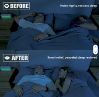 Cloud Flying YA4600 AI Intelligent Breathing Algorithm Throat Massager Snore Stopper