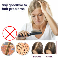 OUHOE Hair Treatment Spray Strengthens Hair, Moisturizes Hair, Improves Dry And Irritated Hair And Hydrates Hair Treatment Spray