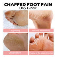 Hoygi Hand and Foot Moisturizing Stick, Foot Care, Hand and Foot Skin Moisturizing and Hydrating Stick