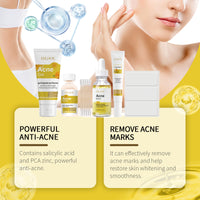 Acne Skin Care Set Skin Care For Acne Skin Is Suitable For Moisturizing And Beautify Soft Skin