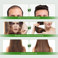 Hair Essential Care Serum Strengthen Roots Reducing Loss Prevent Baldness Nourish Scalp Hair Care Anti-Hair Loss Conditioner